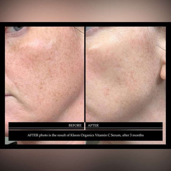 Kleem Organics VITAMIN C SERUM
For glowing and youthful skin - Picture 8 of 14